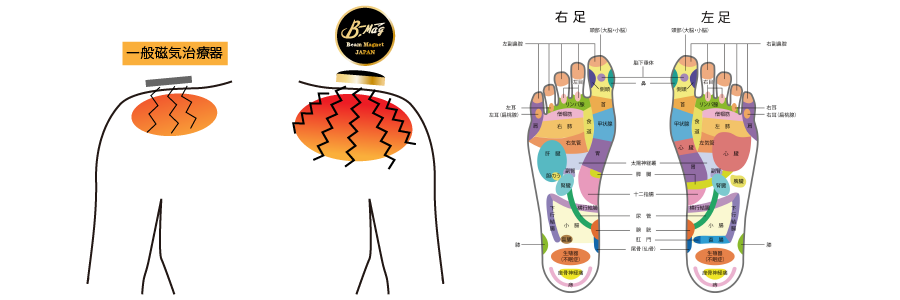 B-Mag（ビーマグ24）と一般磁気治療器との比較