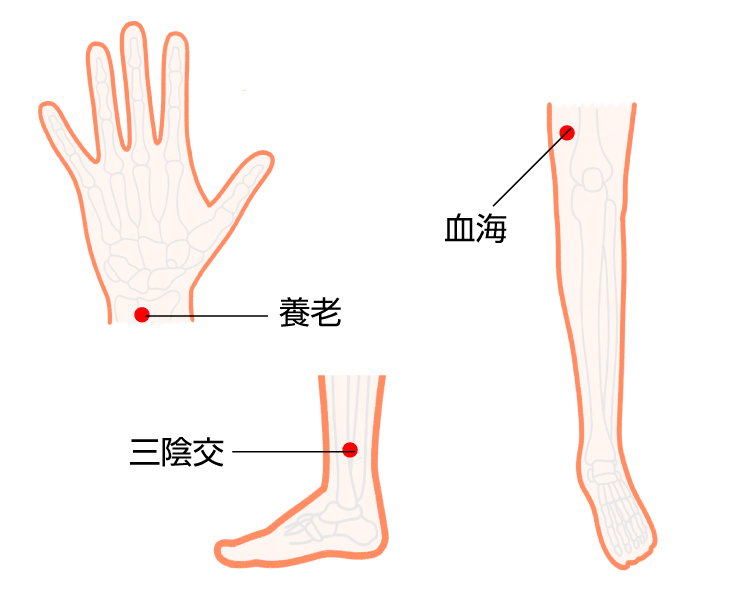 脂肪太りツボイラスト